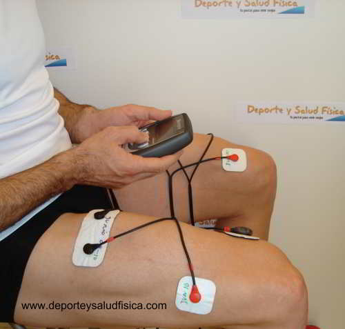 Condromalacia rotuliana con electroestimulación