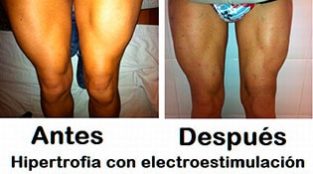 masa muscular electroestimulación