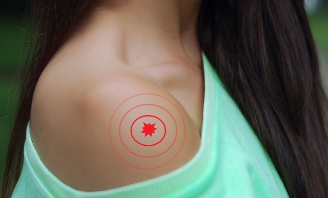Electroestimulacion y dolor de hombro TENS, EMS y MENS