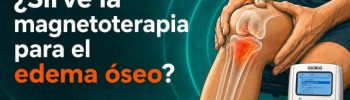 ¿Sirve la magnetoterapia para el edema óseo?