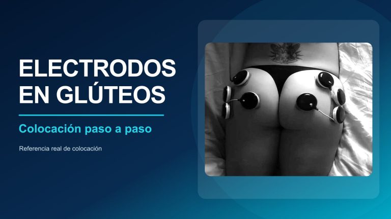 Colocación de electrodos para electroestimulación de glúteos